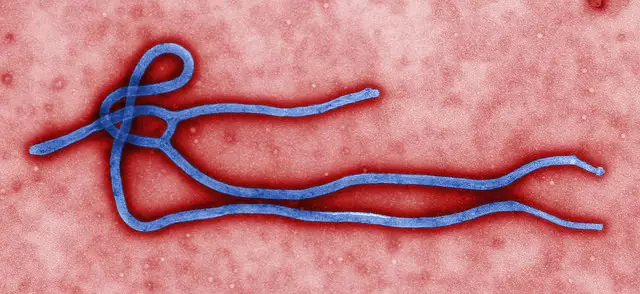 Ebola Not Yet Affecting Business Travel, GBTA Foundation Poll Finds